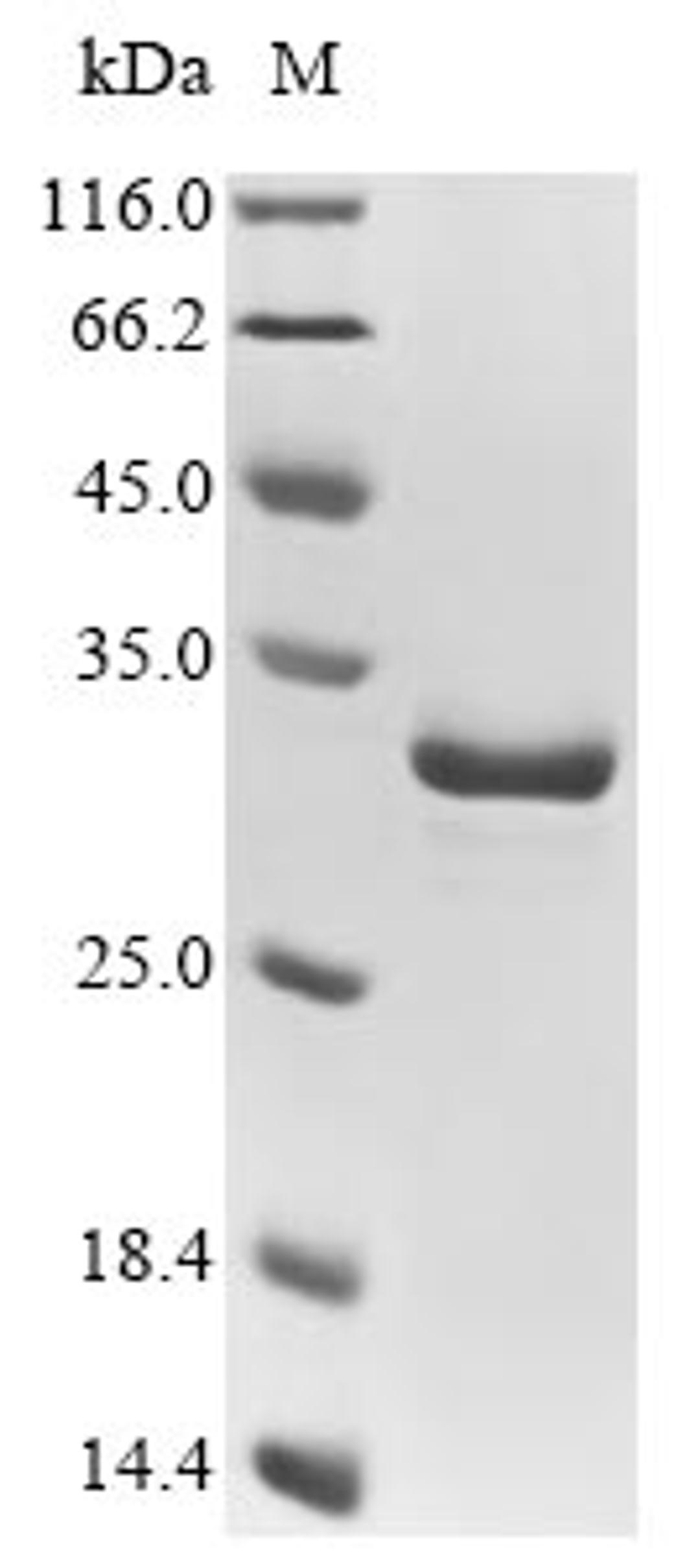 (Tris-Glycine gel) Discontinuous SDS-PAGE (reduced) with 5% enrichment gel and 15% separation gel.