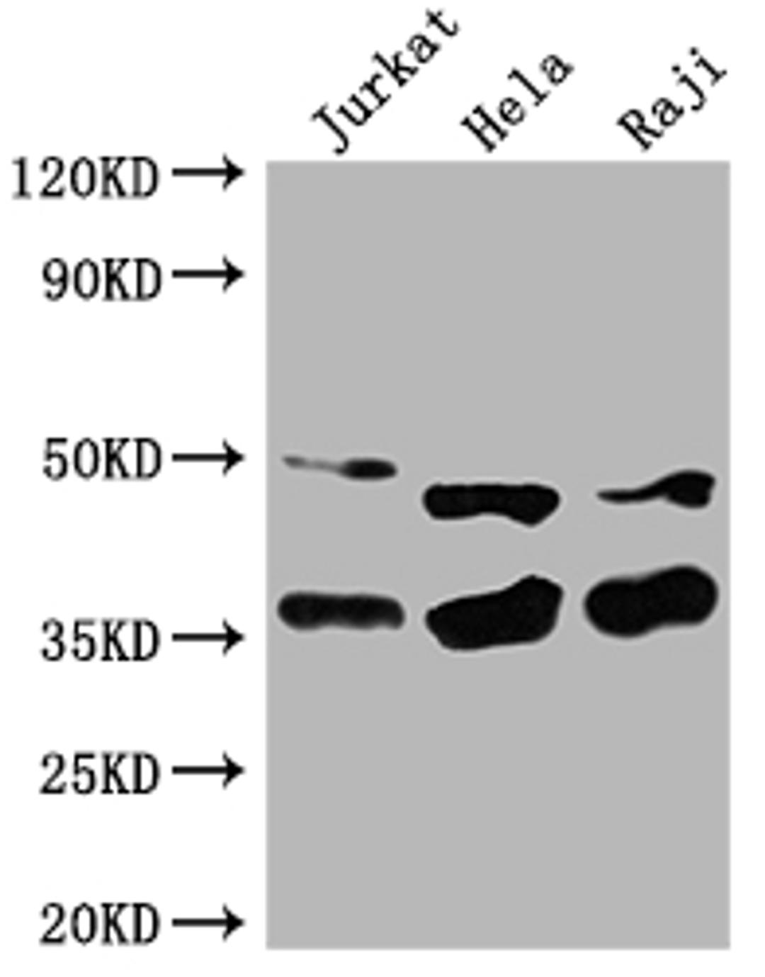 Western Blot. Positive WB detected in: Jurkat whole cell lysate, Hela whole cell lysate, Raji whole cell lysate. All lanes: NFKBIA antibody at 1:2000. Secondary. Goat polyclonal to rabbit IgG at 1/50000 dilution. Predicted band size: 36 kDa. Observed band size: 36 kDa. 