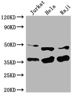 Western Blot. Positive WB detected in: Jurkat whole cell lysate, Hela whole cell lysate, Raji whole cell lysate. All lanes: NFKBIA antibody at 1:2000. Secondary. Goat polyclonal to rabbit IgG at 1/50000 dilution. Predicted band size: 36 kDa. Observed band size: 36 kDa. 