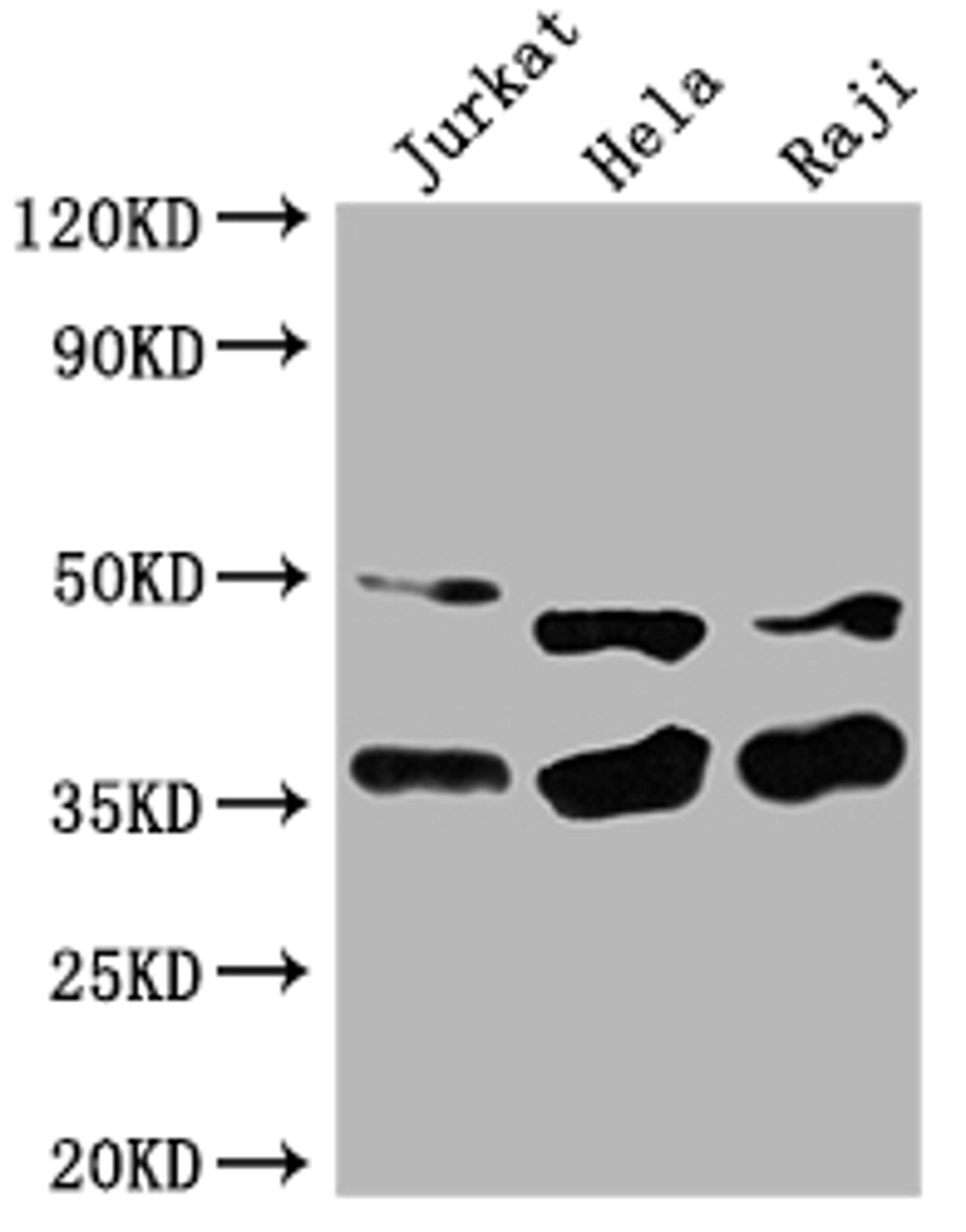Western Blot. Positive WB detected in: Jurkat whole cell lysate, Hela whole cell lysate, Raji whole cell lysate. All lanes: NFKBIA antibody at 1:2000. Secondary. Goat polyclonal to rabbit IgG at 1/50000 dilution. Predicted band size: 36 kDa. Observed band size: 36 kDa. 
