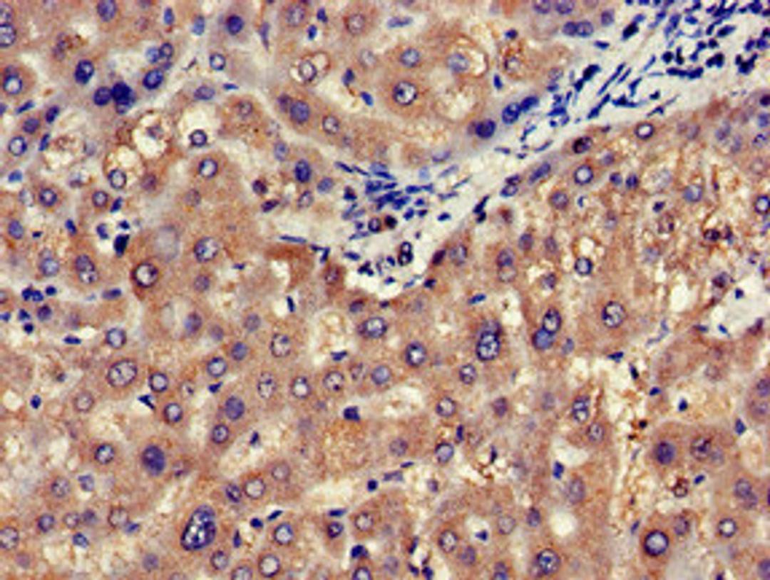 Immunohistochemistry of paraffin-embedded human liver tissue using CSB-PA015942LA01HU at dilution of 1:100