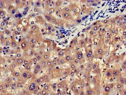 Immunohistochemistry of paraffin-embedded human liver tissue using CSB-PA015942LA01HU at dilution of 1:100