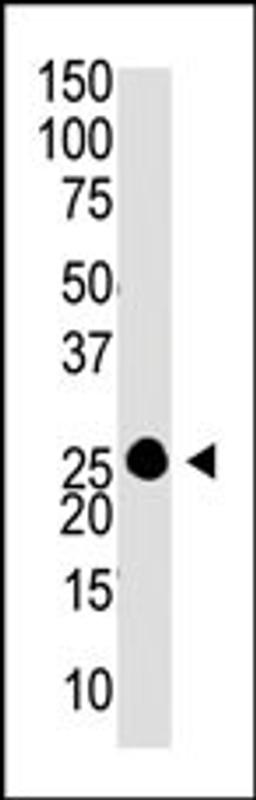 Antibody is used in Western blot to detect GCAP1 in Y79 cell lysate.