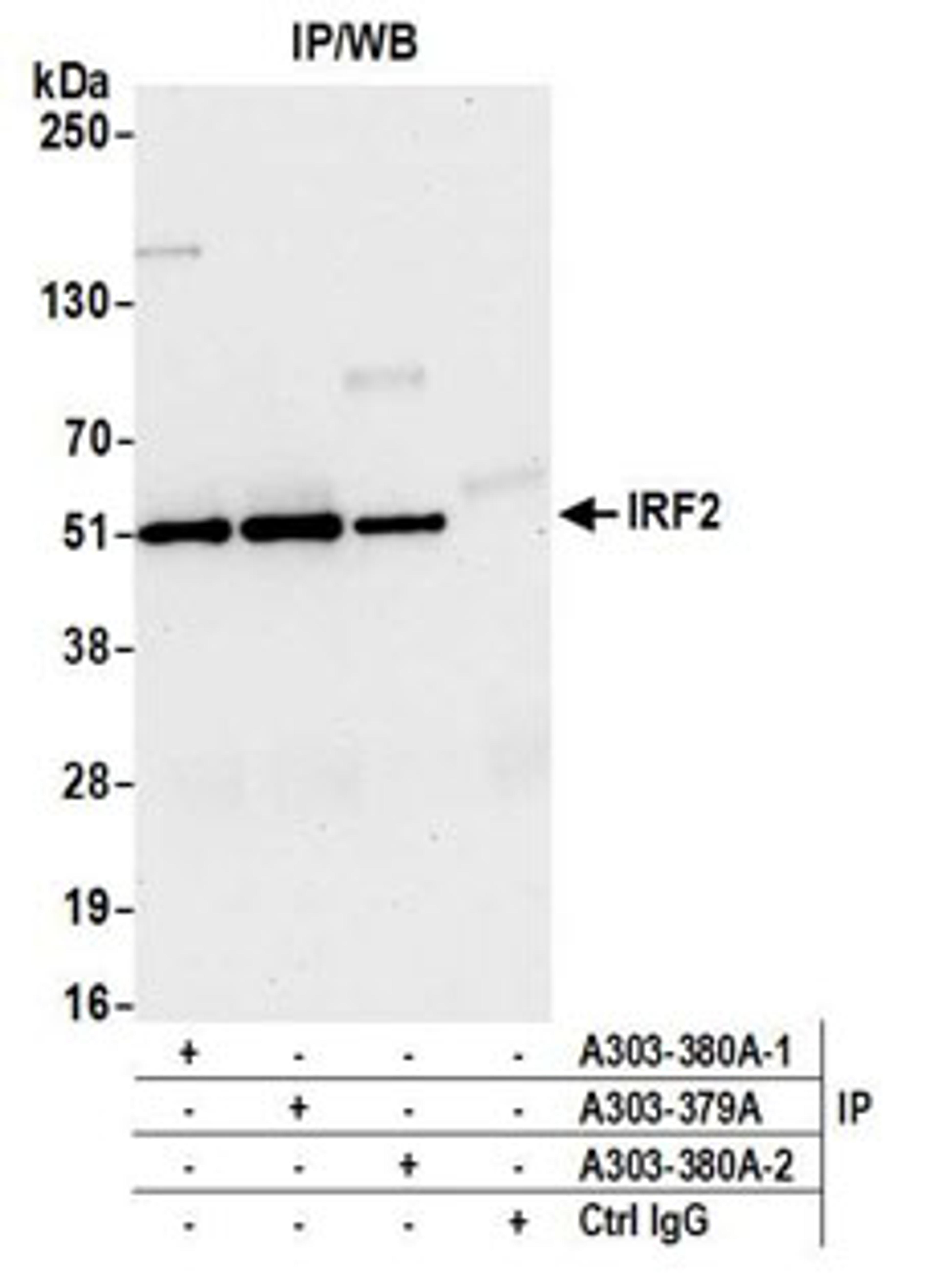 Detection of human IRF2 by western blot of immunoprecipitates. Samples: Whole cell lysate (1.0 mg per IP reaction; 20% of IP loaded) from Jurkat cells prepared using NETN lysis buffer. <i>Antibodies:</i> Affinity purified rabbit anti-IRF2 antibody (A303-380A lot 2) used for IP at 6 µg per reaction. IRF2 was also immunoprecipitated by a previous lot of this antibody (A303-380A lot 1) and another rabbit anti-IRF2 antibody (A303-379A). For blotting immunoprecipitated IRF2, A303-380A was used at 0.04 µg/ml. <i>Detection:</i> Chemiluminescence with an exposure time of 30 seconds.