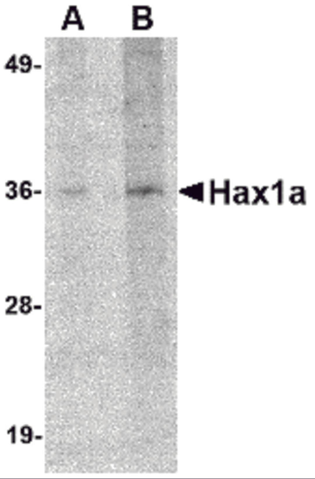 Western blot analysis of Hax1a in human brain tissue lysate with Hax1a antibody at (A) 1 and (B) 2 &#956;g/mL.