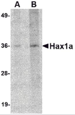 Western blot analysis of Hax1a in human brain tissue lysate with Hax1a antibody at (A) 1 and (B) 2 μg/mL.