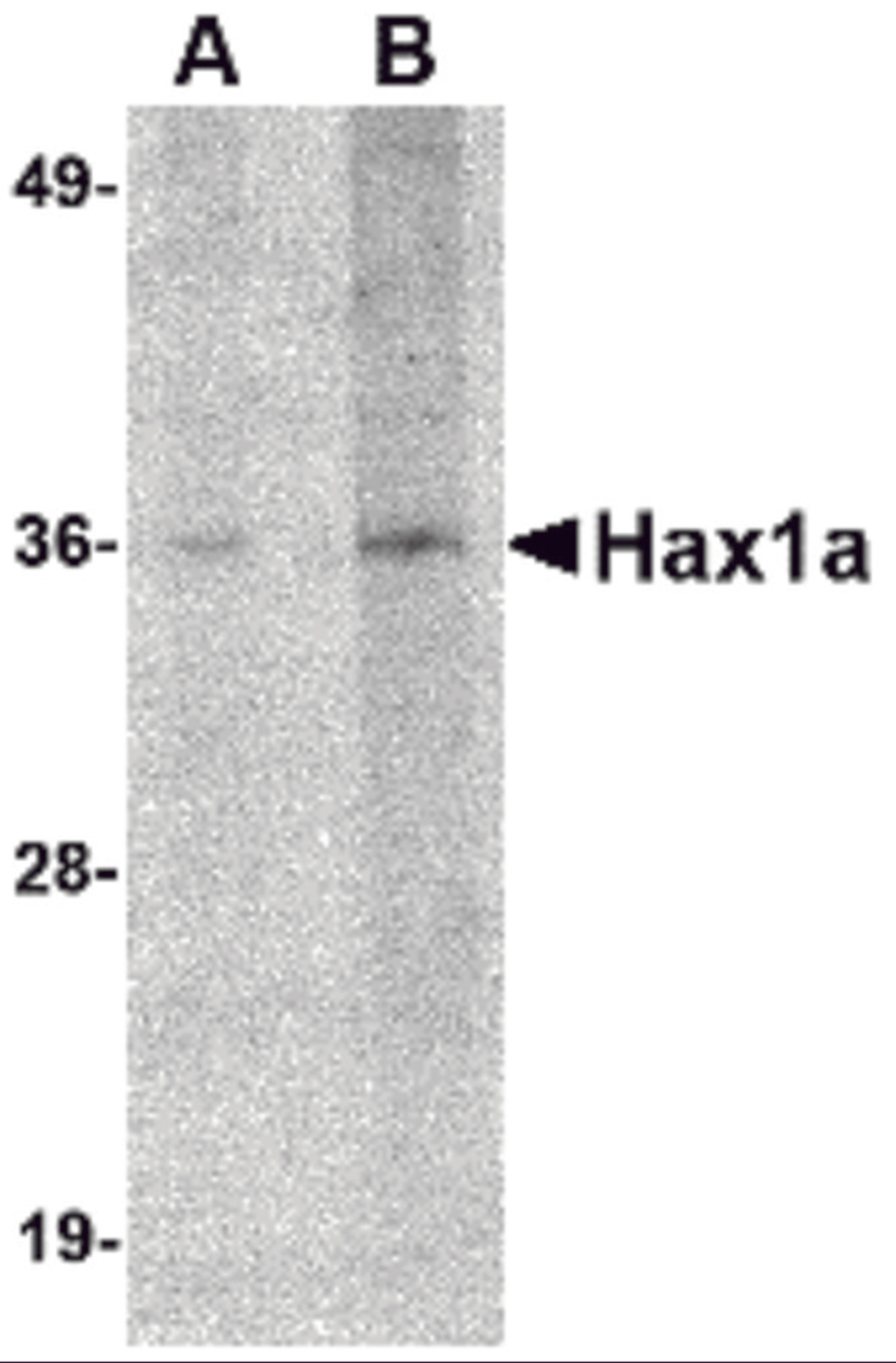 Western blot analysis of Hax1a in human brain tissue lysate with Hax1a antibody at (A) 1 and (B) 2 μg/mL.