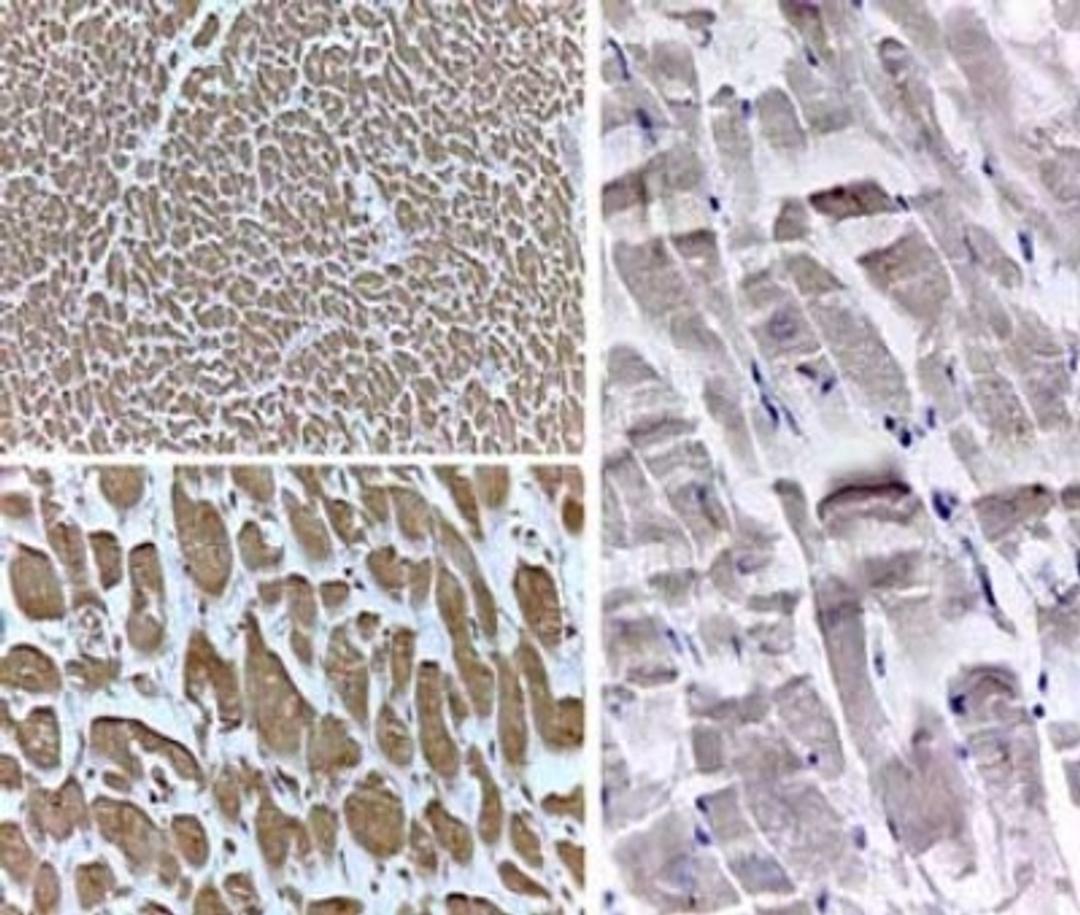 Immunohistochemistry: PPAR delta/NR1C2 Antibody [NB600-637] - Rabbit Anti-PPAR delta (N terminal specific).