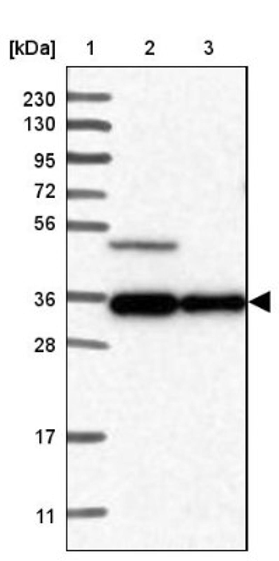 Western Blot: TTC23L Antibody [NBP1-83559] - Lane 1: Marker [kDa] 230, 130, 95, 72, 56, 36, 28, 17, 11<br/>Lane 2: Human cell line RT-4<br/>Lane 3: Human cell line U-251MG sp