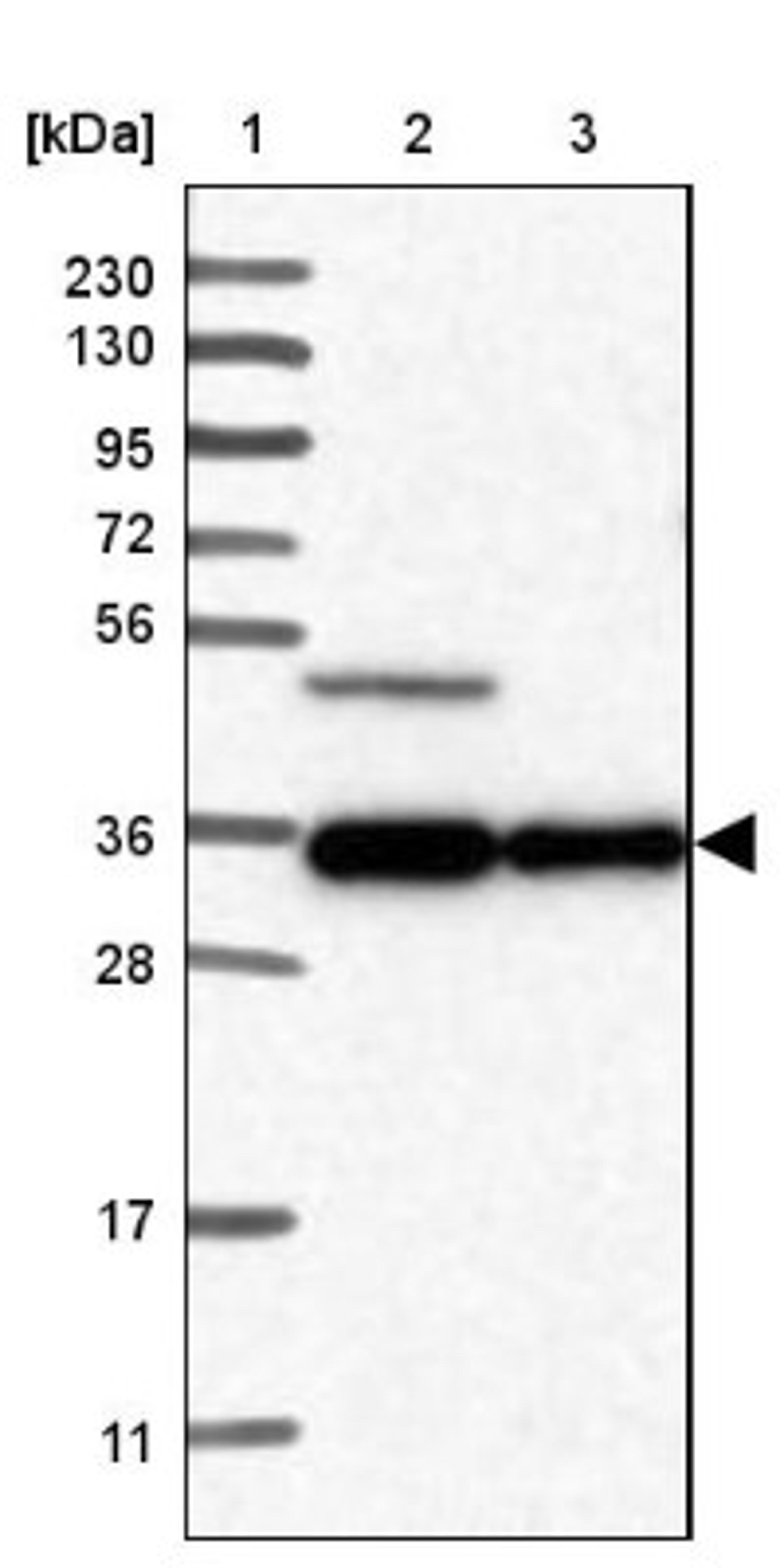 Western Blot: TTC23L Antibody [NBP1-83559] - Lane 1: Marker [kDa] 230, 130, 95, 72, 56, 36, 28, 17, 11<br/>Lane 2: Human cell line RT-4<br/>Lane 3: Human cell line U-251MG sp