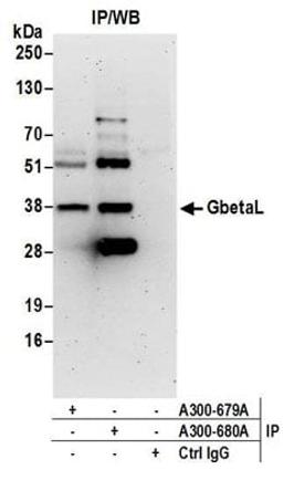 Detection of human GbetaL by western blot of immunoprecipitates.