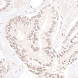 Detection of human NP95/UHRF1 by immunohistochemistry.