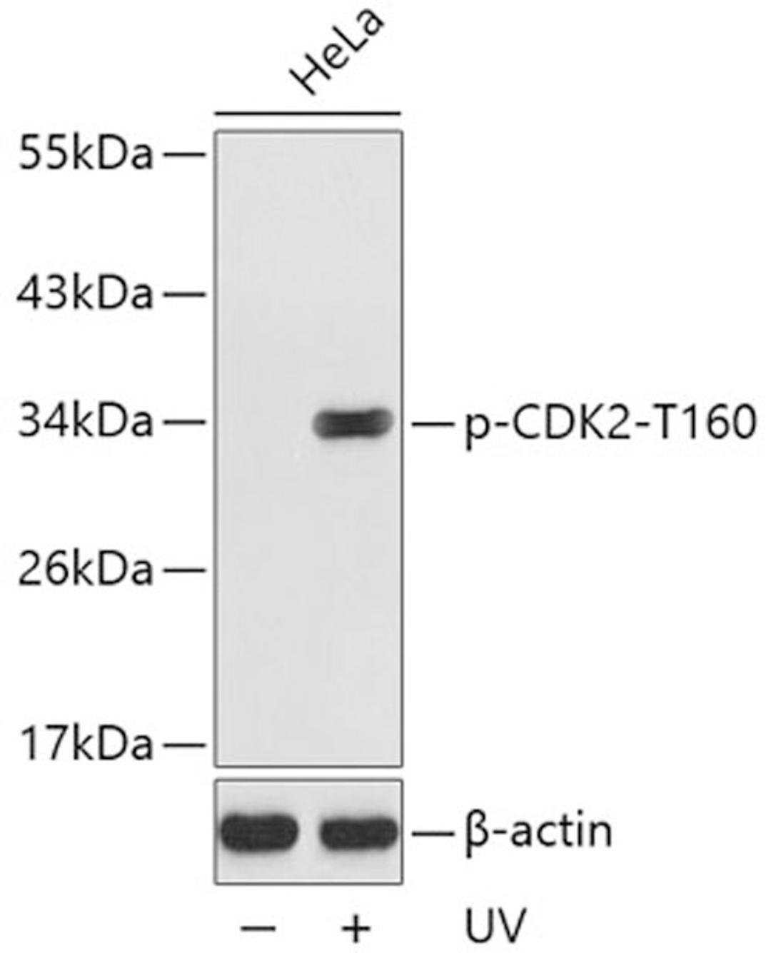 Western blot - Phospho-CDK2-T160 antibody (AP0325)