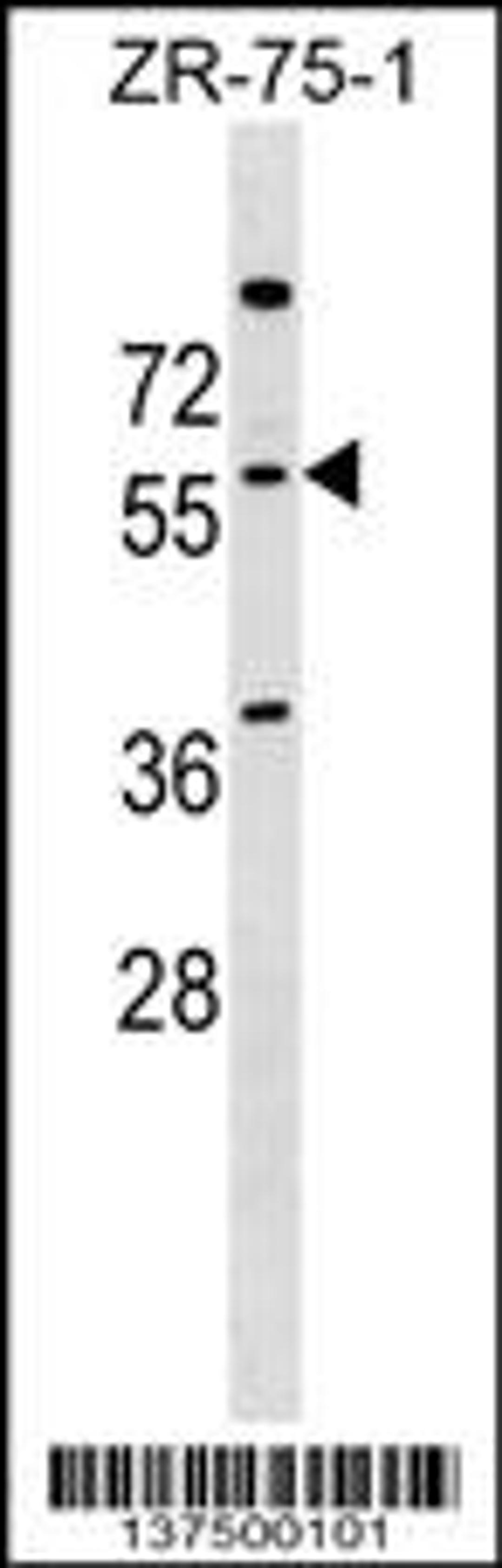 Western blot analysis in ZR-75-1 cell line lysates (35ug/lane).