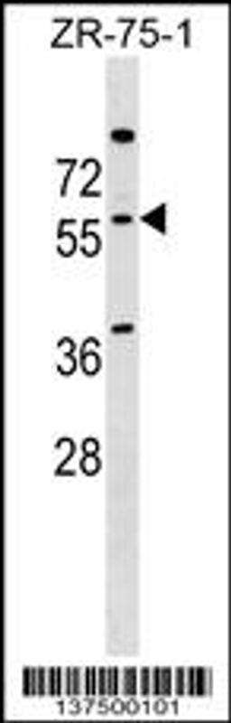 Western blot analysis in ZR-75-1 cell line lysates (35ug/lane).