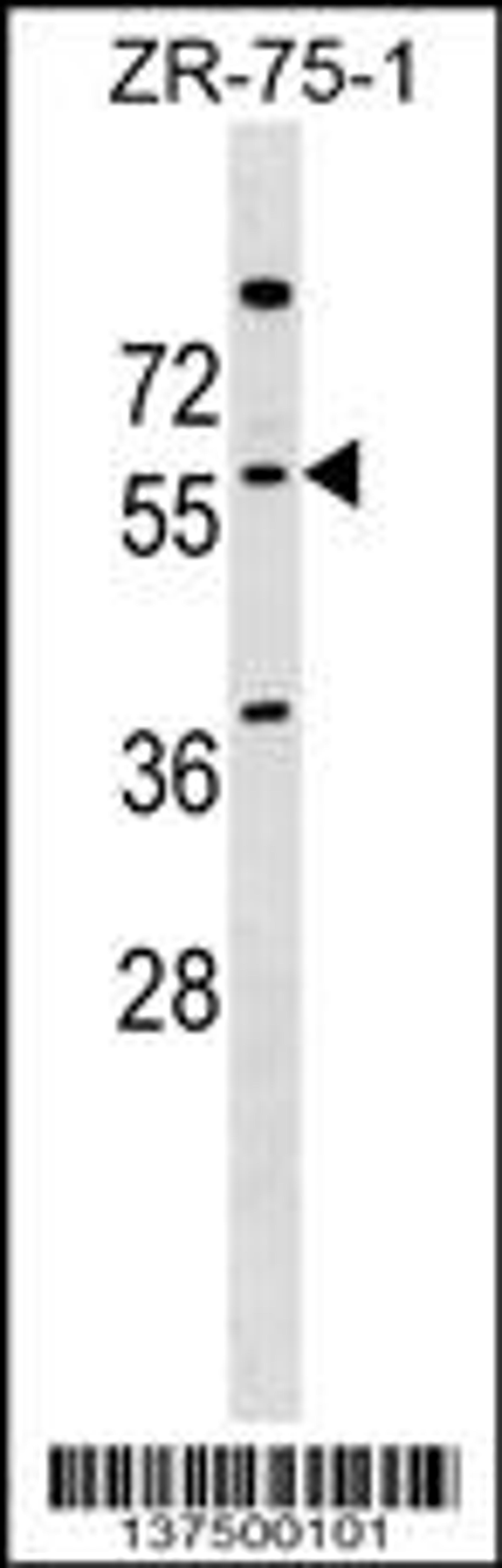 Western blot analysis in ZR-75-1 cell line lysates (35ug/lane).