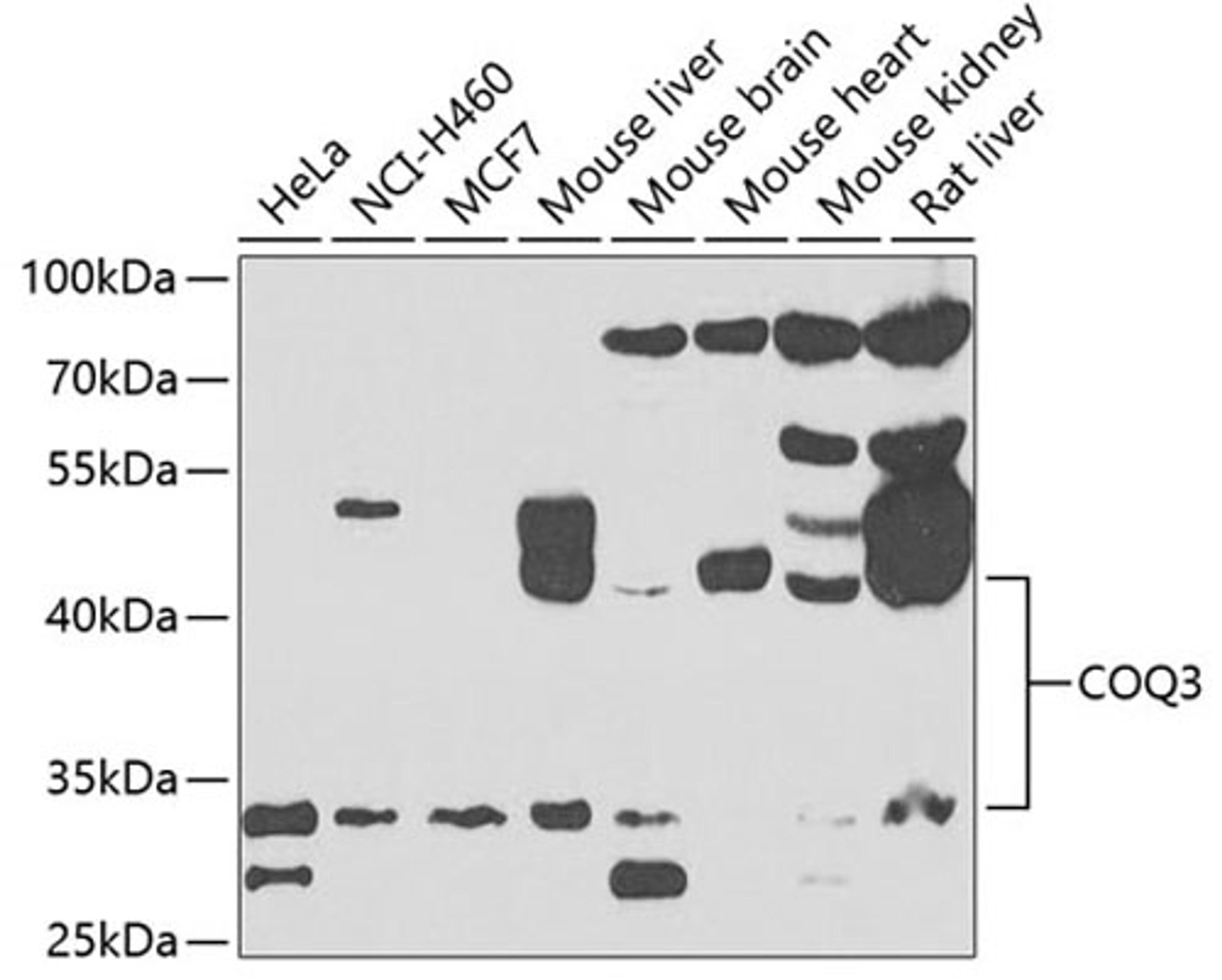 Western blot - COQ3 antibody (A7469)