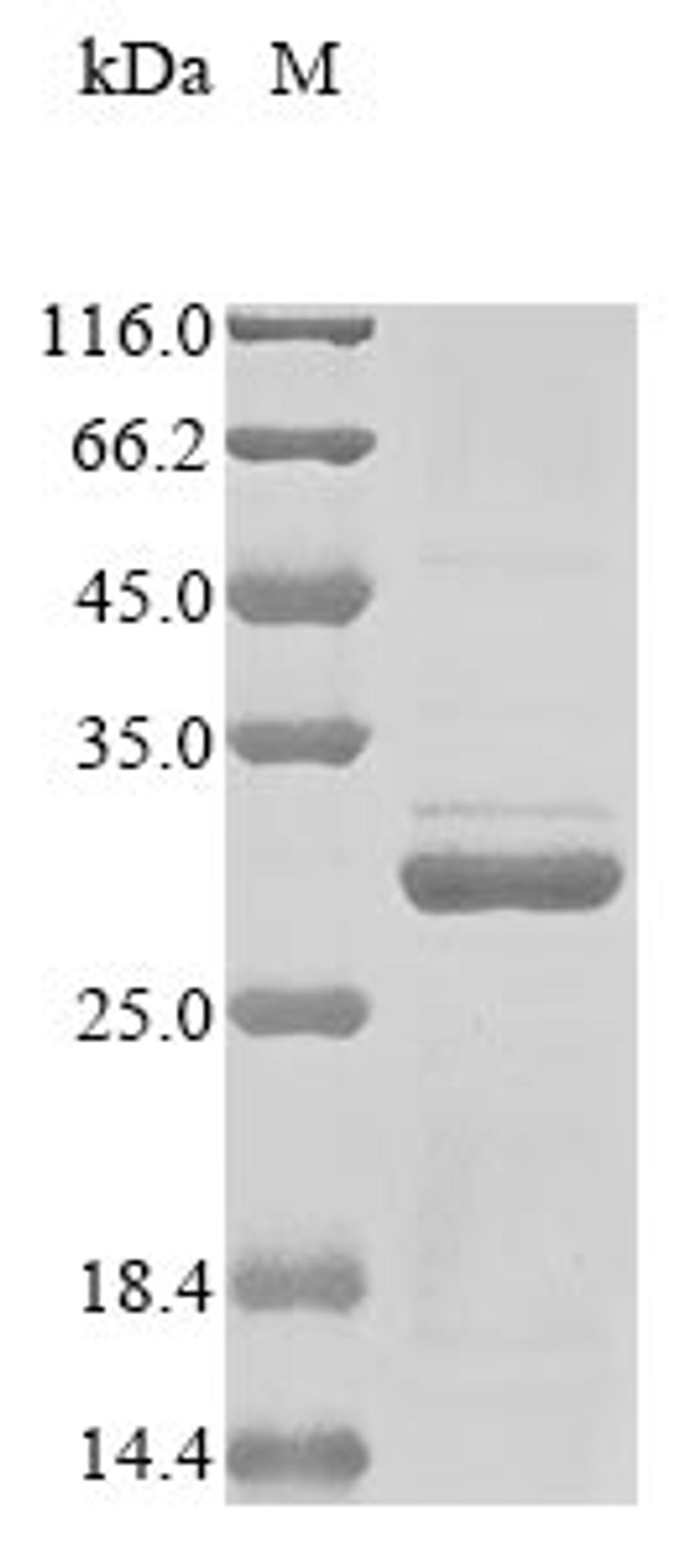 (Tris-Glycine gel) Discontinuous SDS-PAGE (reduced) with 5% enrichment gel and 15% separation gel.