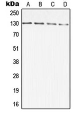 Western blot analysis of A431 (Lane 1), HCT116 (Lane 2), SP2/0 (Lane 3), PC12 (Lane 4) whole cell lysates using DIAPH2 antibody