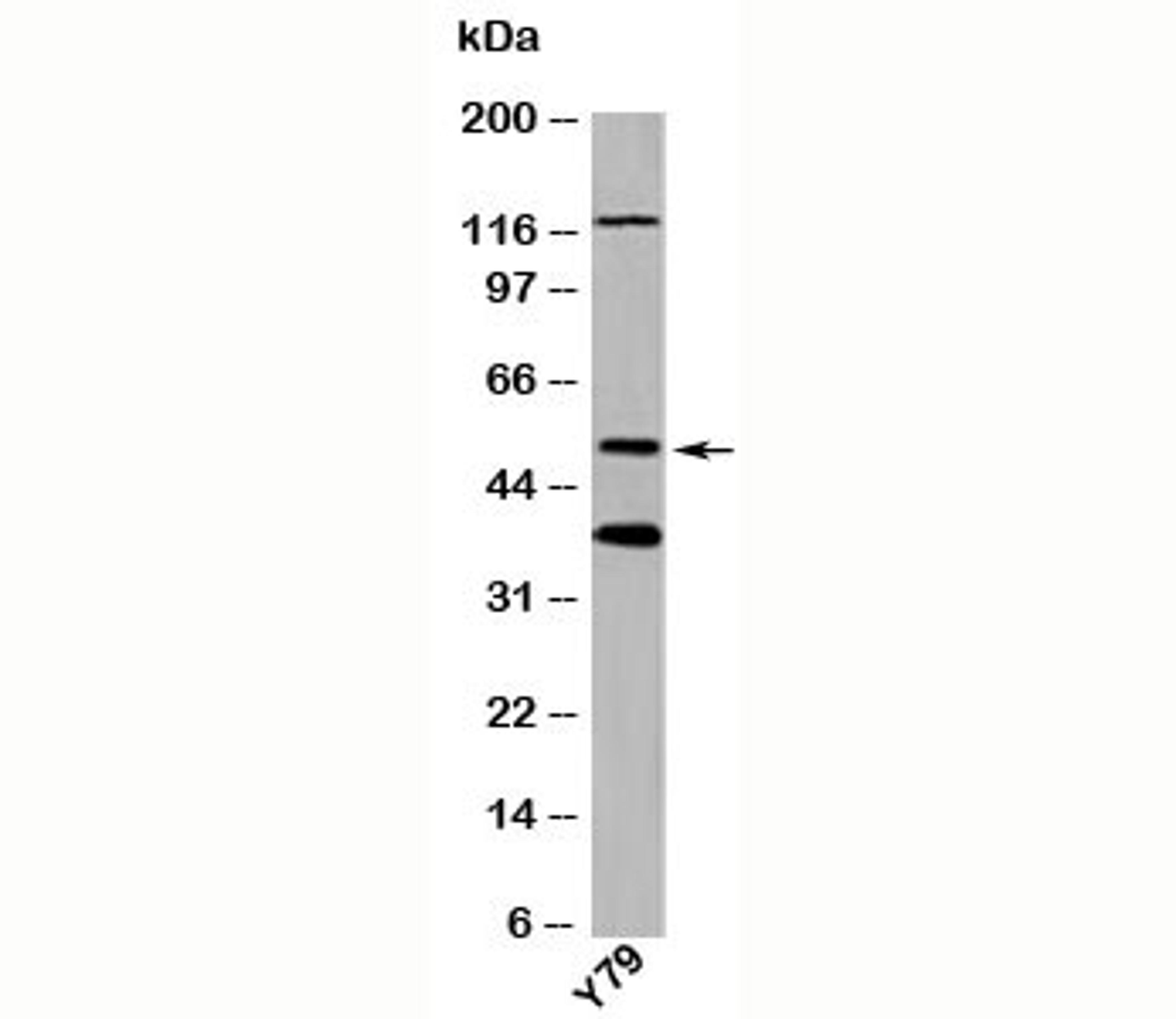 Western blot testing of human samples with TXNIP antibody at 1ug/ml.