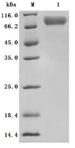 (Tris-Glycine gel) Discontinuous SDS-PAGE (reduced) with 5% enrichment gel and 15% separation gel.