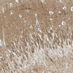 Immunohistochemistry: ATP8A1 Antibody [NBP2-30403] - Human hippocampus.