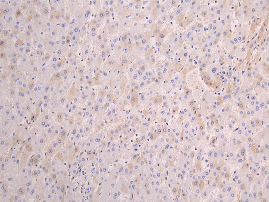 IHC image of CSB-RA001898MA1HUU diluted at 1:100 and staining in paraffin-embedded human liver tissue performed on a Leica BondTM system. After dewaxing and hydration, antigen retrieval was mediated by high pressure in a citrate buffer (pH 6.0). Section was blocked with 10% normal goat serum 30min at RT. Then primary antibody (1% BSA) was incubated at 4°C overnight. The primary is detected by a Goat anti-human polymer IgG labeled by HRP and visualized using 0.05% DAB.
