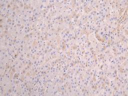 IHC image of CSB-RA001898MA1HUU diluted at 1:100 and staining in paraffin-embedded human liver tissue performed on a Leica BondTM system. After dewaxing and hydration, antigen retrieval was mediated by high pressure in a citrate buffer (pH 6.0). Section was blocked with 10% normal goat serum 30min at RT. Then primary antibody (1% BSA) was incubated at 4°C overnight. The primary is detected by a Goat anti-human polymer IgG labeled by HRP and visualized using 0.05% DAB.