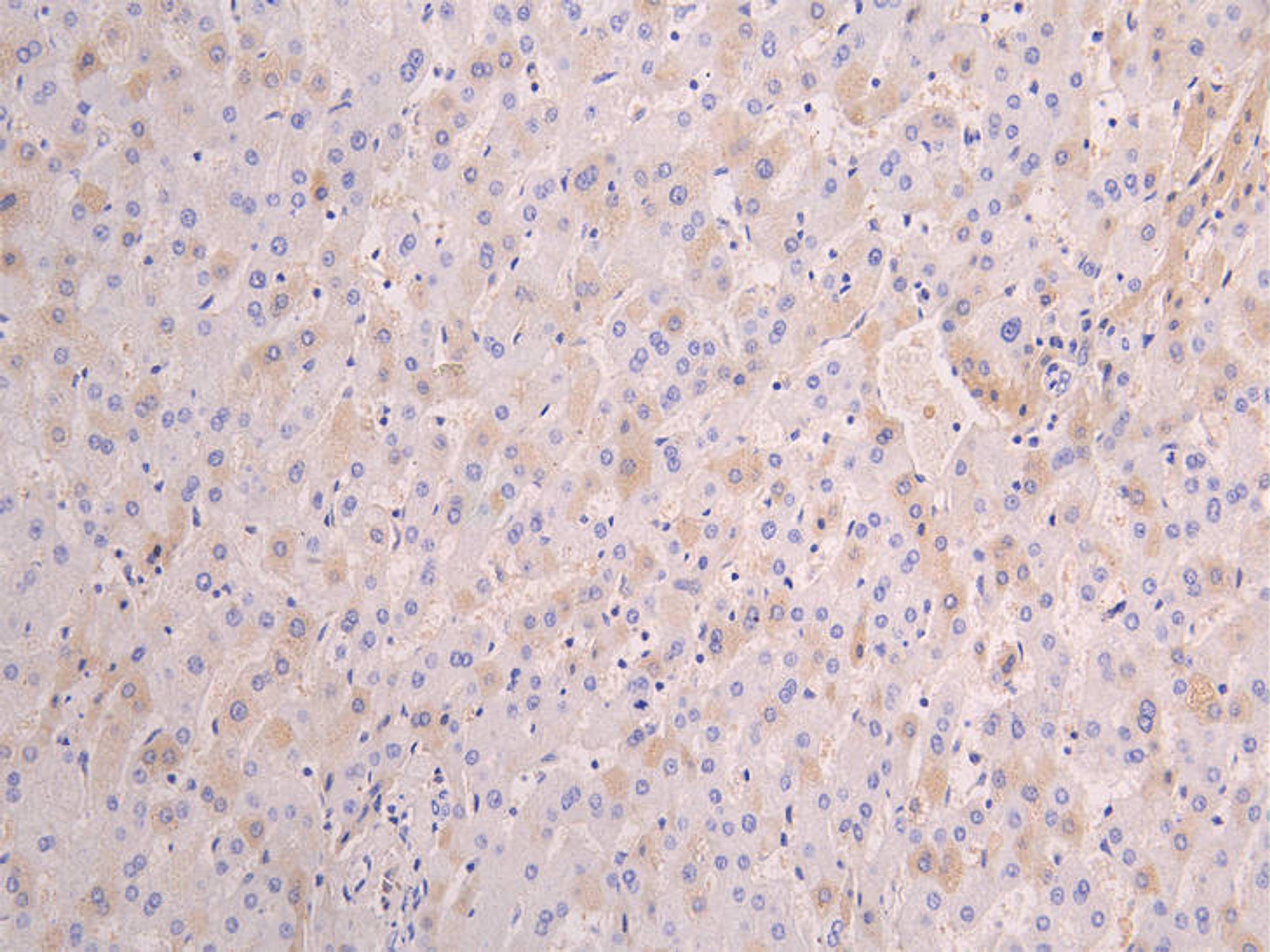 IHC image of CSB-RA001898MA1HUU diluted at 1:100 and staining in paraffin-embedded human liver tissue performed on a Leica BondTM system. After dewaxing and hydration, antigen retrieval was mediated by high pressure in a citrate buffer (pH 6.0). Section was blocked with 10% normal goat serum 30min at RT. Then primary antibody (1% BSA) was incubated at 4°C overnight. The primary is detected by a Goat anti-human polymer IgG labeled by HRP and visualized using 0.05% DAB.