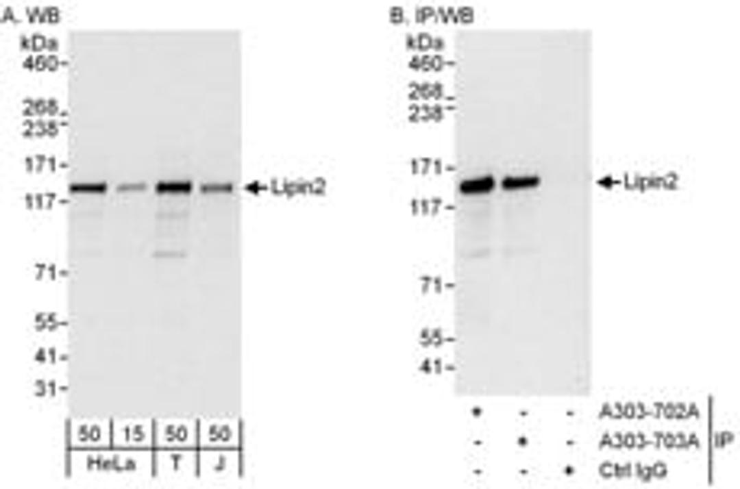 Detection of human Lipin2 by western blot and immunoprecipitation.