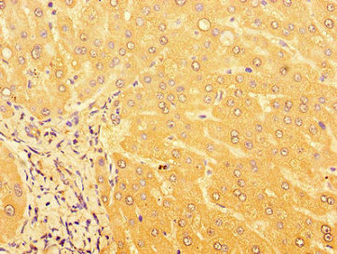 Immunohistochemistry of paraffin-embedded human liver tissue using CSB-PA757664LA01HU at dilution of 1:100