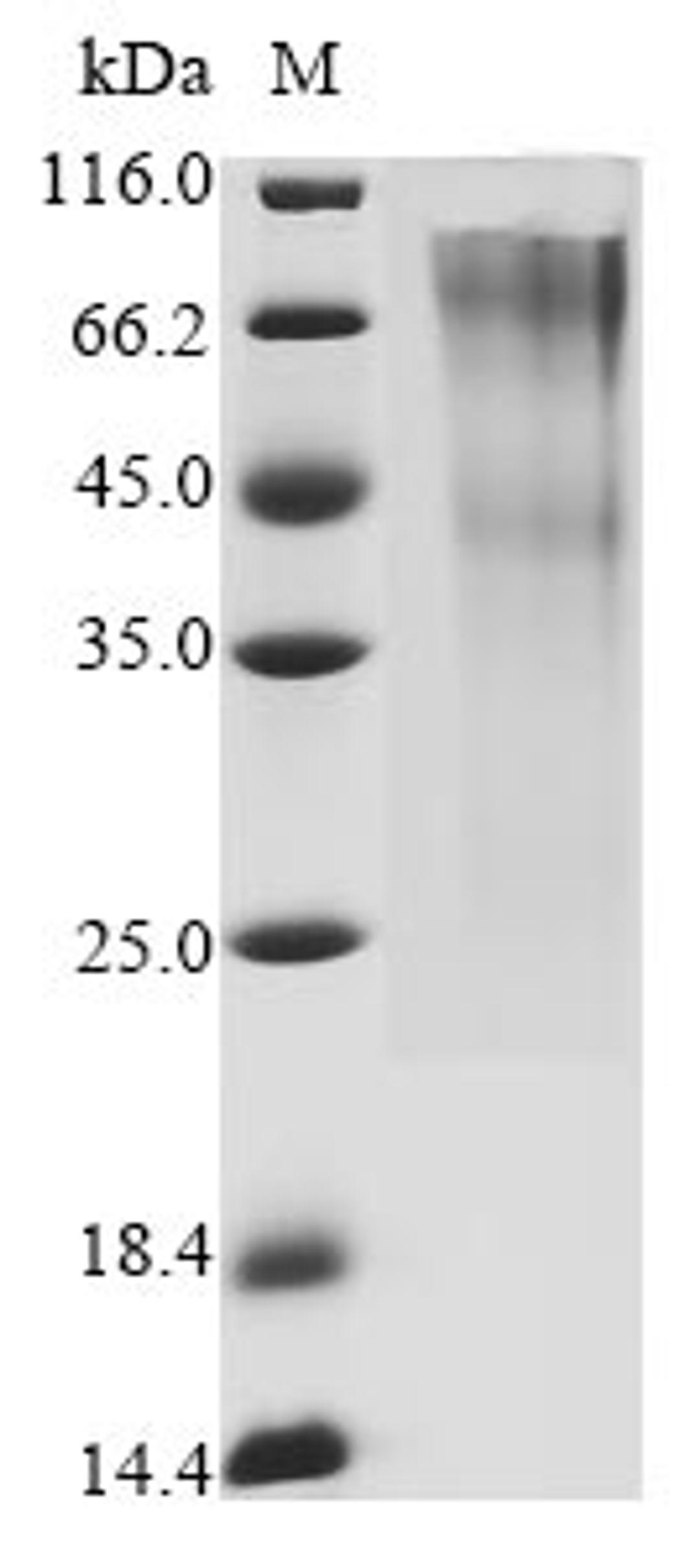(Tris-Glycine gel) Discontinuous SDS-PAGE (reduced) with 5% enrichment gel and 15% separation gel.