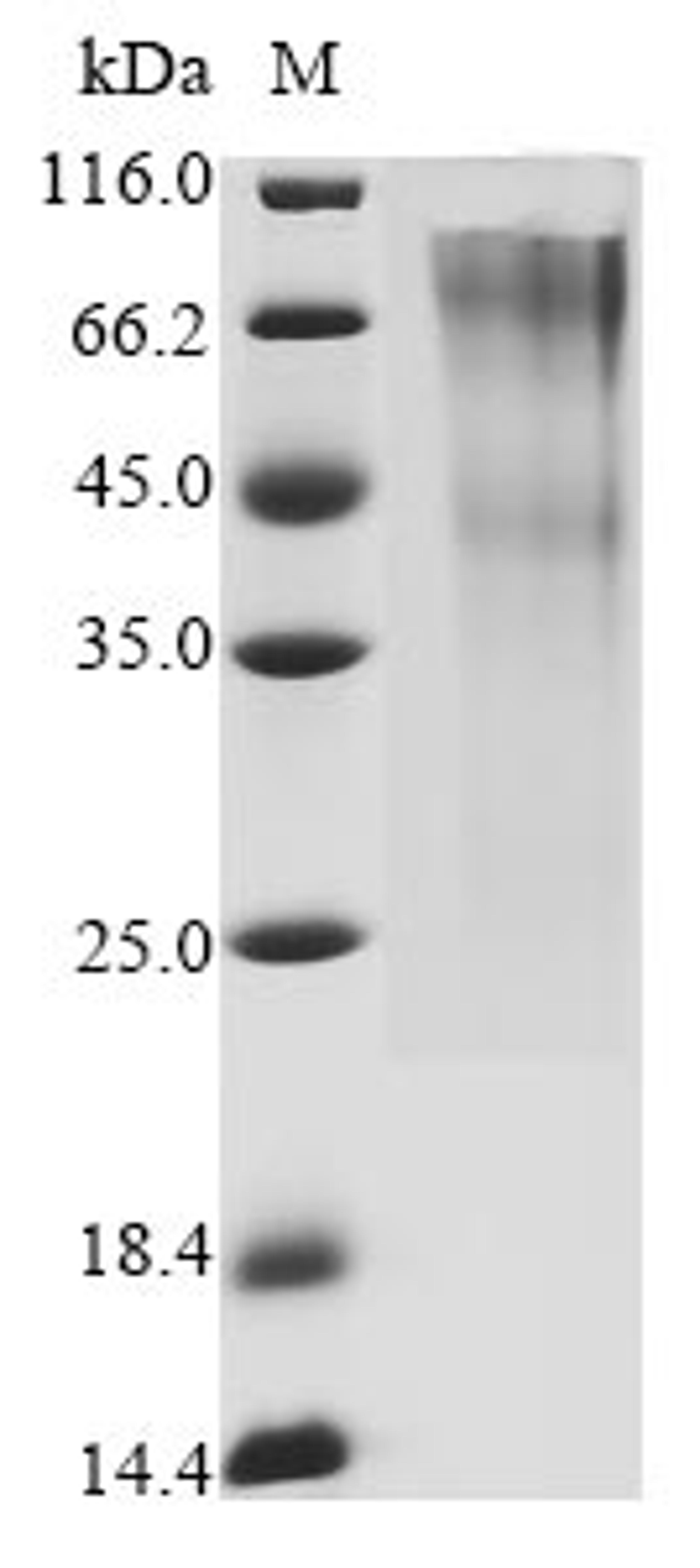 (Tris-Glycine gel) Discontinuous SDS-PAGE (reduced) with 5% enrichment gel and 15% separation gel.