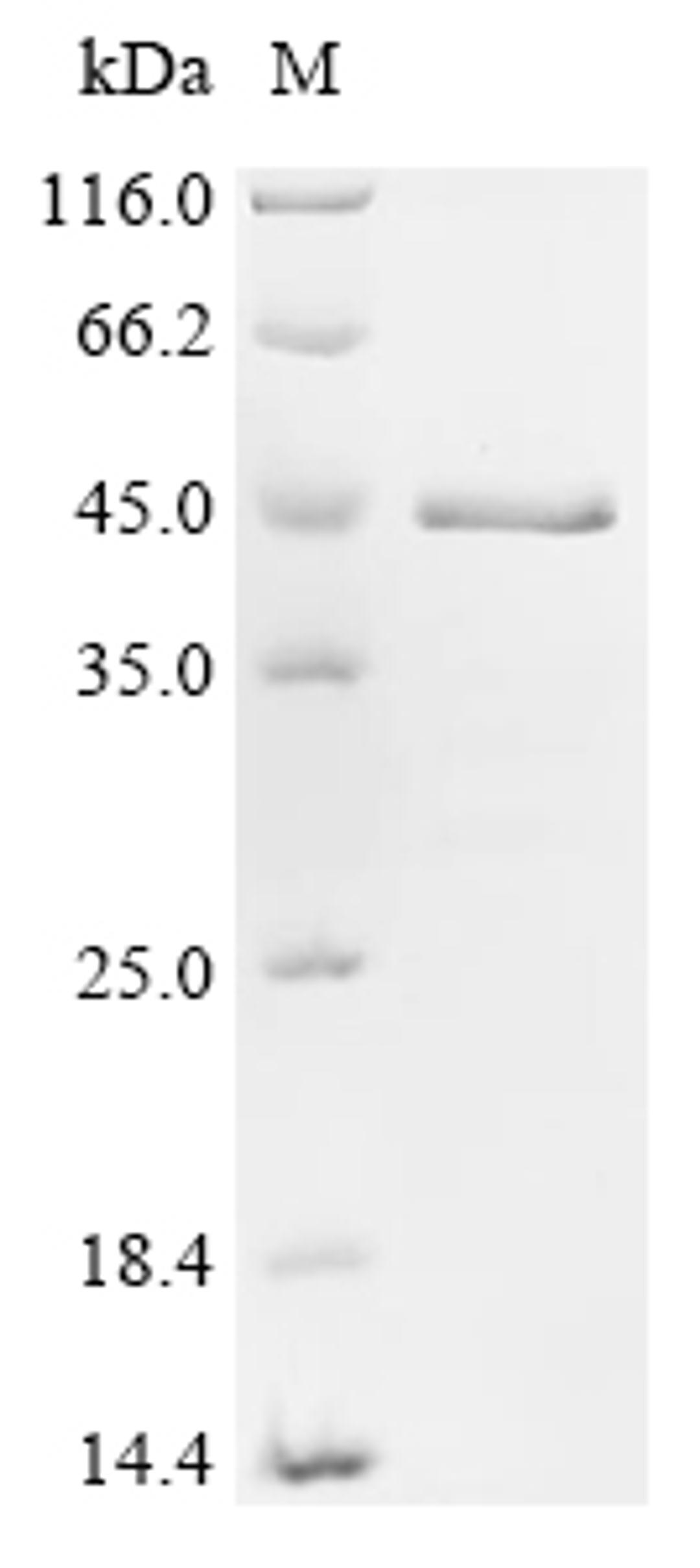 (Tris-Glycine gel) Discontinuous SDS-PAGE (reduced) with 5% enrichment gel and 15% separation gel.