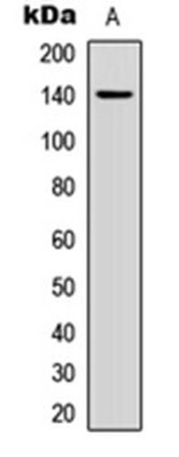 Western blot analysis of MCF7 (Lane 1) whole cell lysates using Collagen 2 alpha 1 antibody