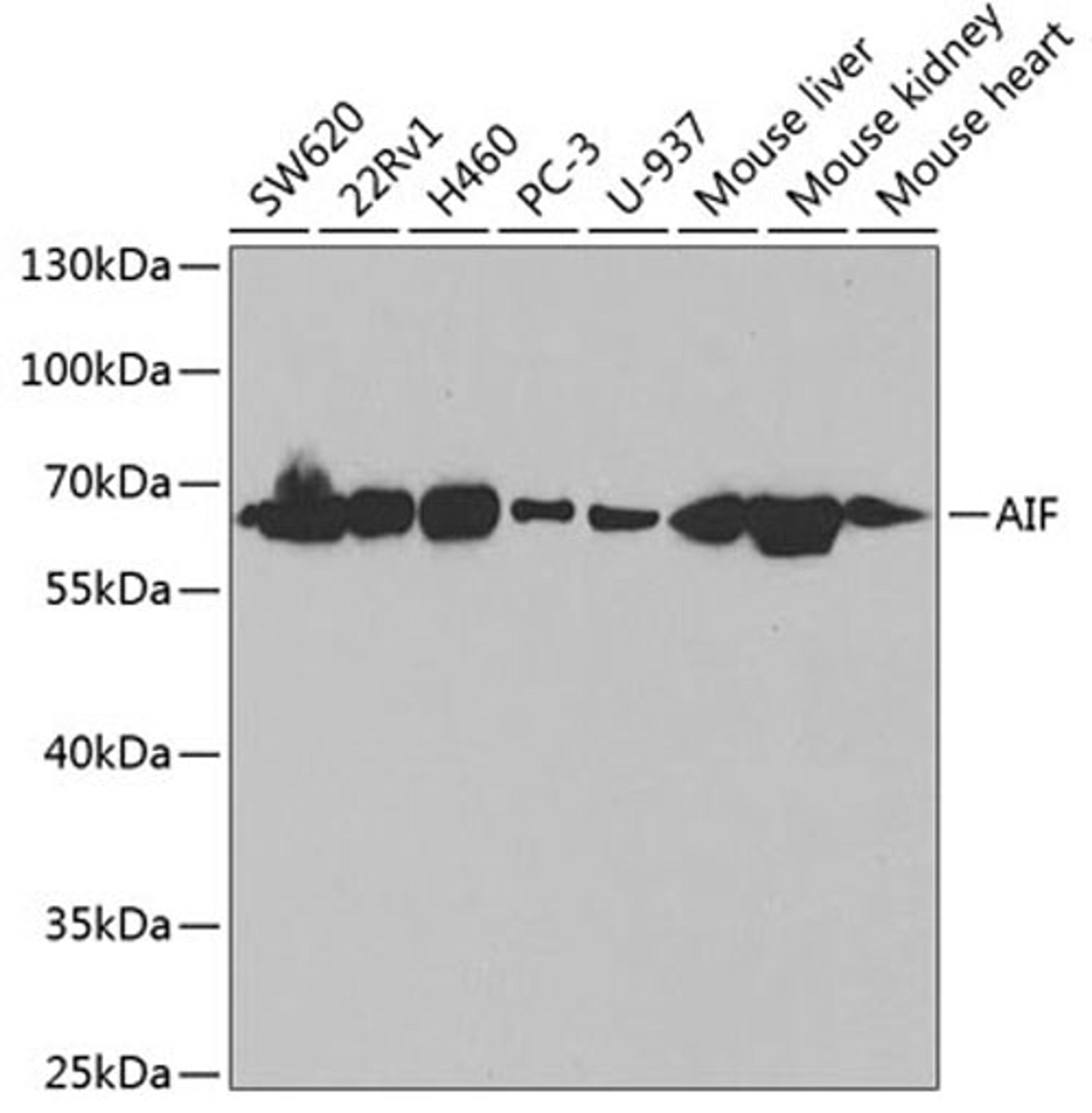 Western blot - AIF antibody (A2568)