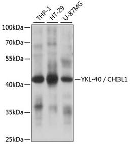 Western blot - YKL-40 / CHI3L1 antibody (A1723)