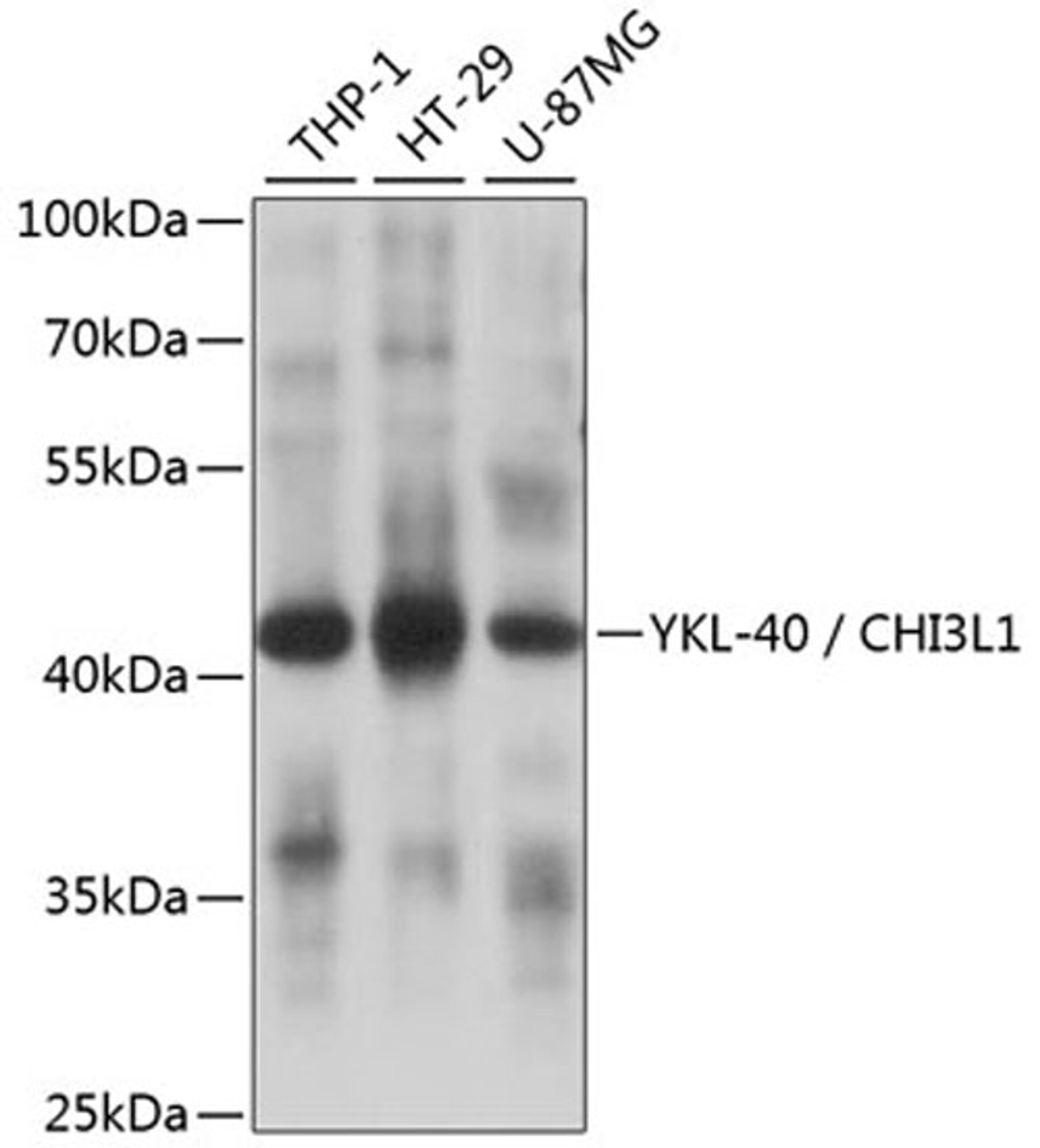 Western blot - YKL-40 / CHI3L1 antibody (A1723)