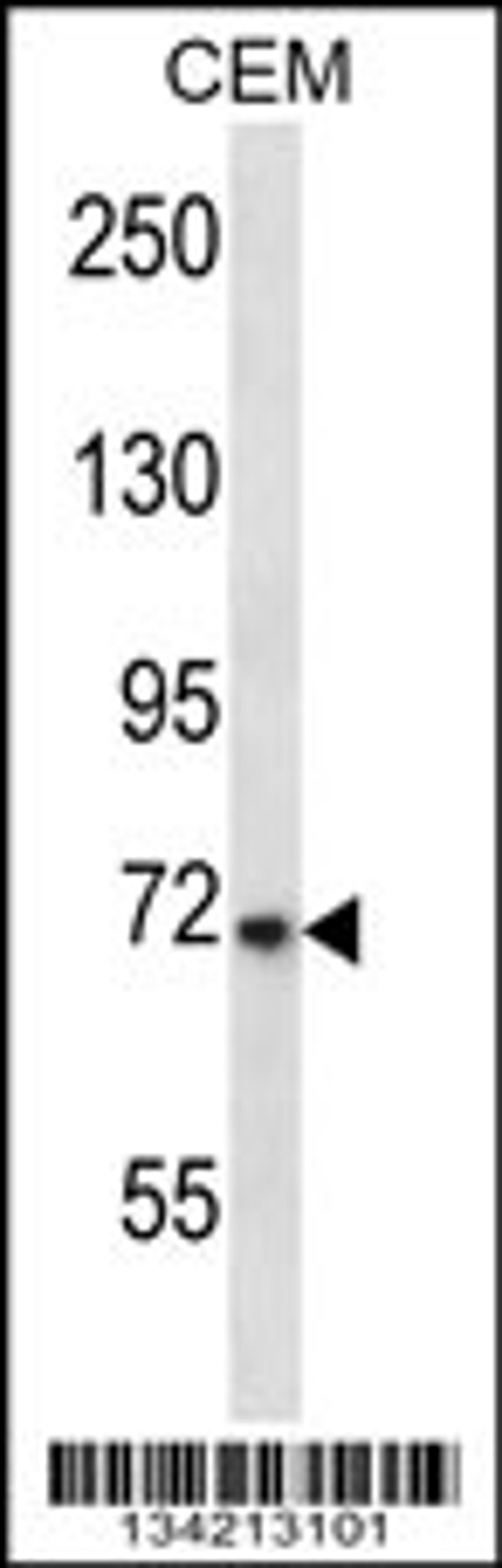 Western blot analysis in CEM cell line lysates (35ug/lane).