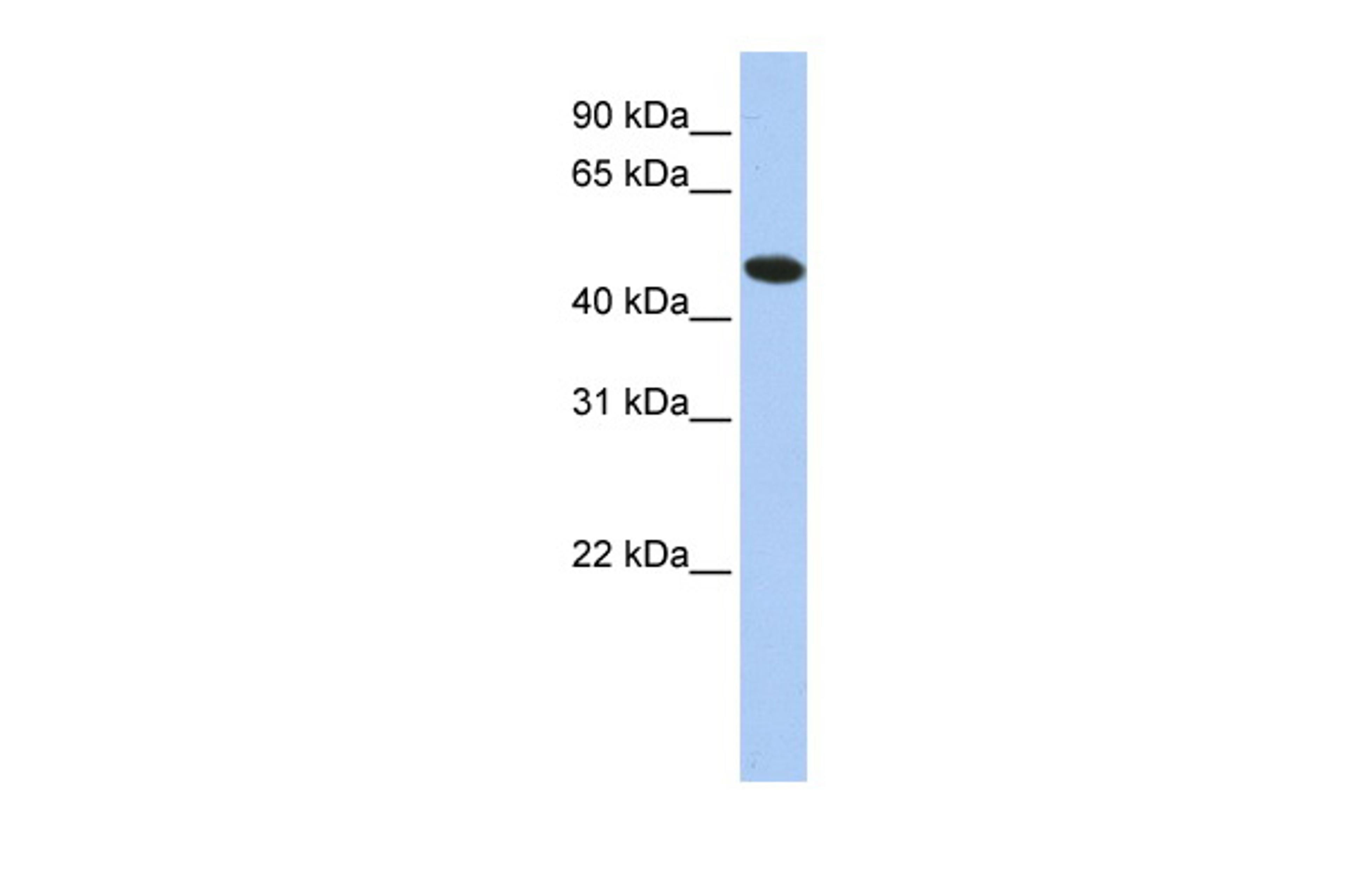 Antibody used in WB on Human HepG2 at 0.2-1 ug/ml.