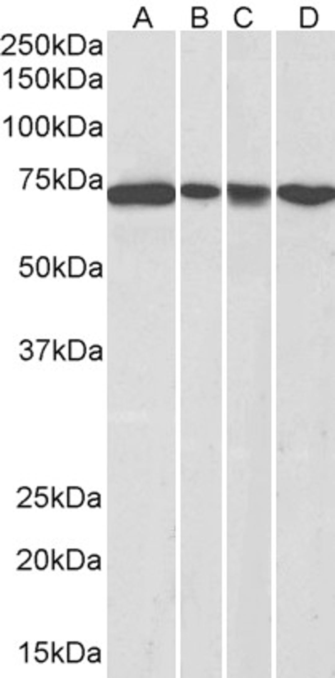 45-470 (0.3ug/ml) staining of NIH3T3 (A), HeLa (B), A431 (C) and Jurkat (D) nuclear lysates (35ug protein in RIPA buffer). Detected by chemiluminescence.