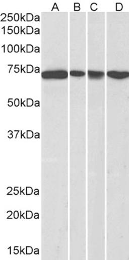 45-470 (0.3ug/ml) staining of NIH3T3 (A), HeLa (B), A431 (C) and Jurkat (D) nuclear lysates (35ug protein in RIPA buffer). Detected by chemiluminescence.