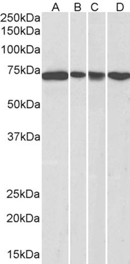 45-470 (0.3ug/ml) staining of NIH3T3 (A), HeLa (B), A431 (C) and Jurkat (D) nuclear lysates (35ug protein in RIPA buffer). Detected by chemiluminescence.