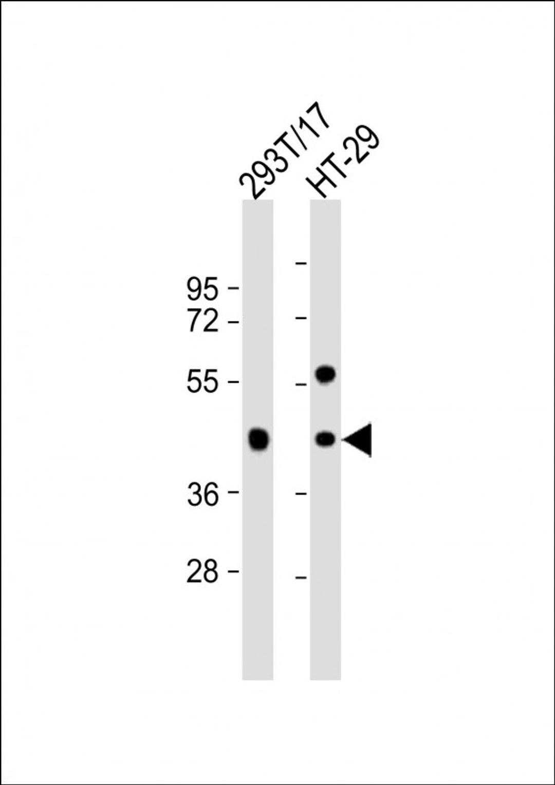 Western Blot at 1:1000 dilution Lane 1: 293T/17 whole cell lysate Lane 2: HT-29 whole cell lysate Lysates/proteins at 20 ug per lane.