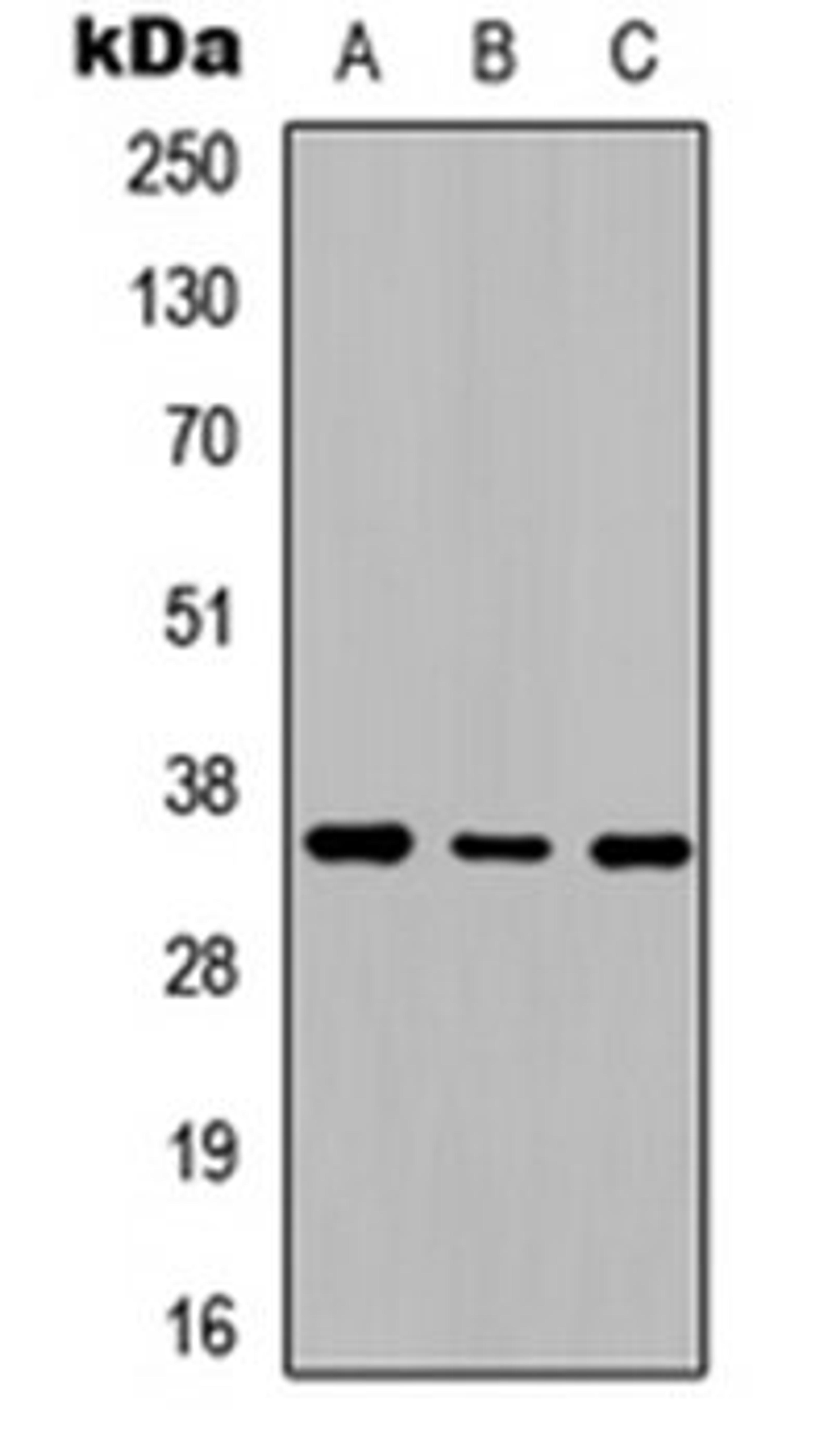 Western blot analysis of SHSY5Y (Lane 1), NIH3T3 (Lane 2), rat kidney (Lane 3) whole cell lysates using Adenosine A2b Receptor antibody