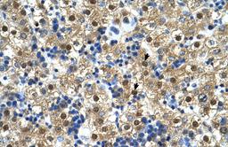 Antibody used in IHC on Human Liver.