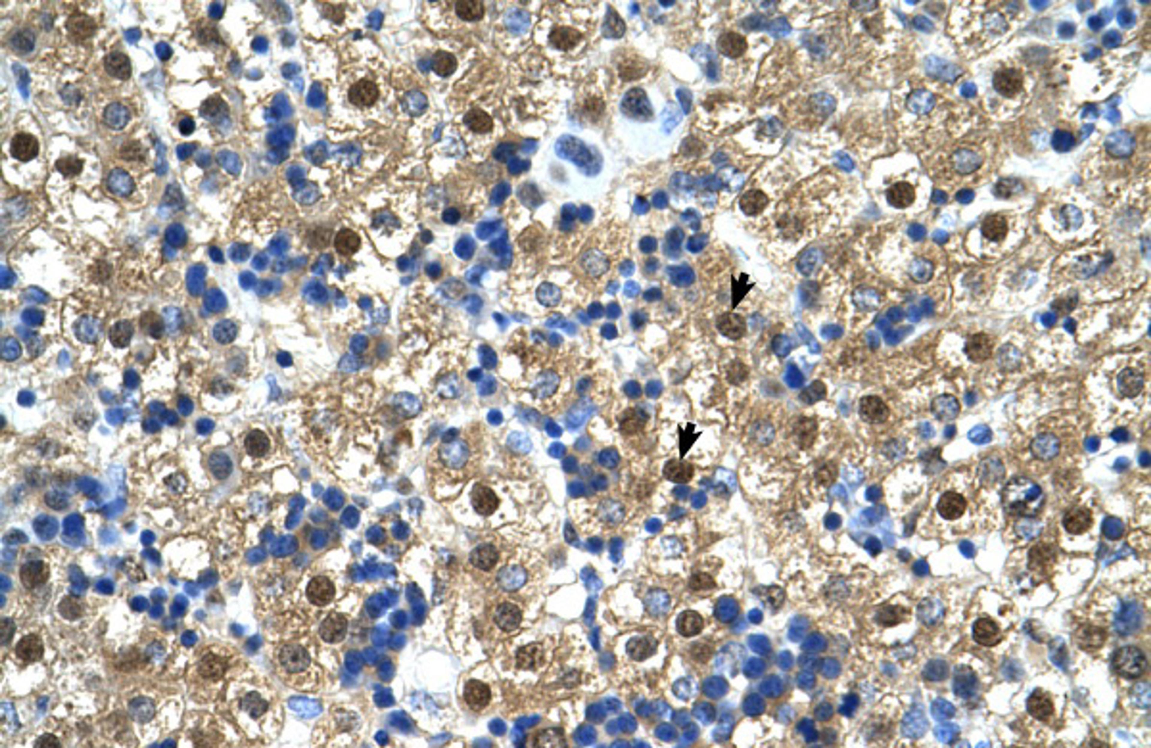 Antibody used in IHC on Human Liver.