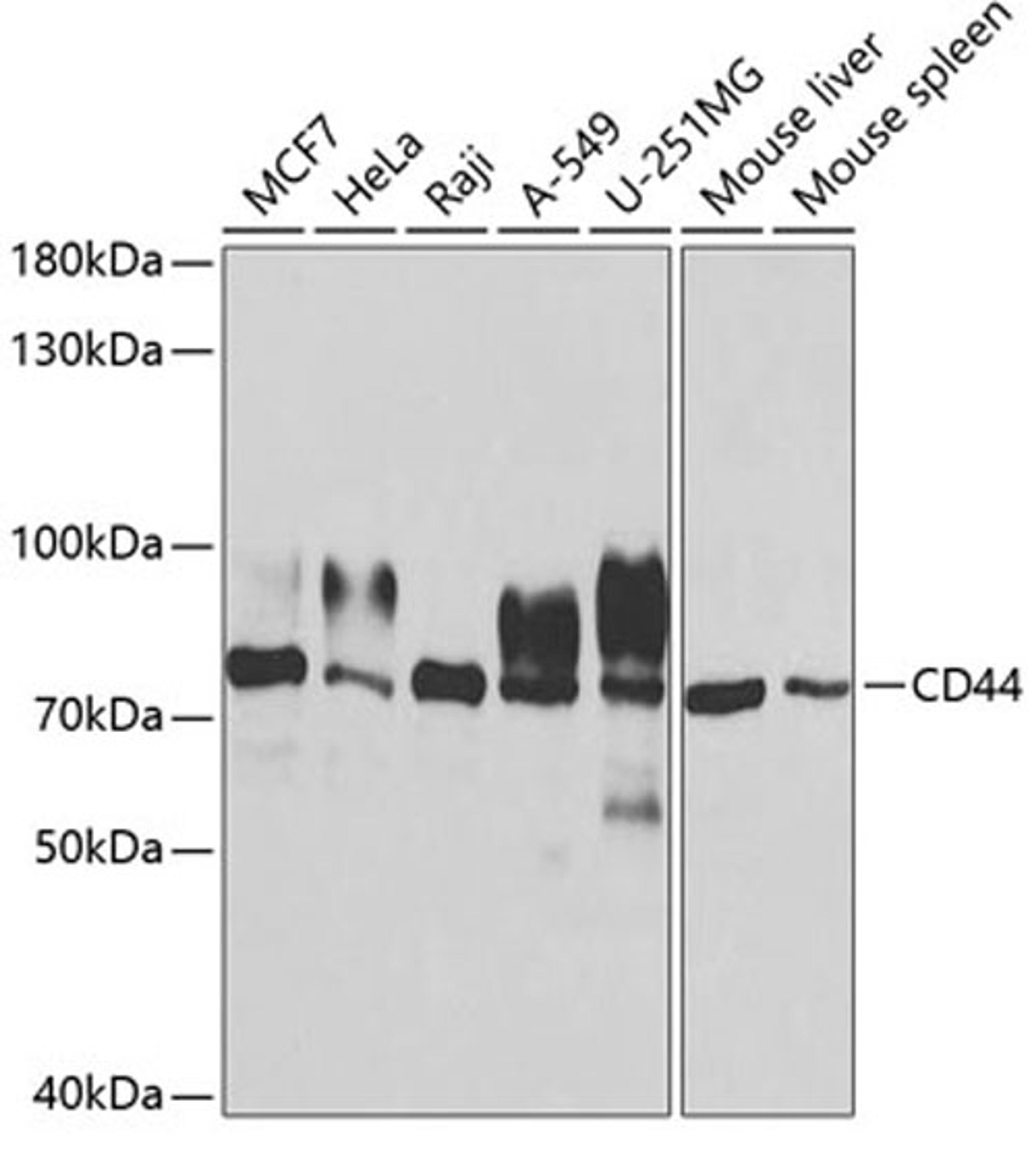 Western blot - CD44 antibody (A1351)