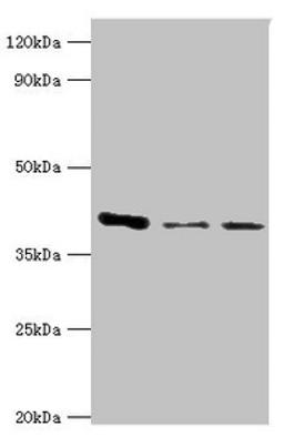 Western blot. All lanes: E3 Ribonucleoside-diphosphate reductase subunit M2 B antibody at 6ug/ml. Lane 1: MCF-7 whole cell lysate. Lane 2: Hela whole cell lysate. Lane 3: HepG2 whole cell lysate. Secondary. Goat polyclonal to rabbit IgG at 1/10000 dilution. Predicted band size: 41, 35, 16, 8, 5, 49 kDa. Observed band size: 41 kDa.