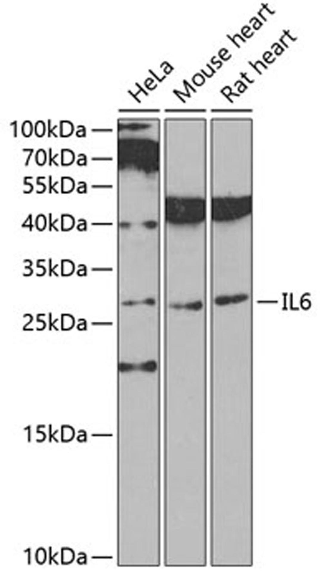 Western blot - IL6 antibody (A0286)